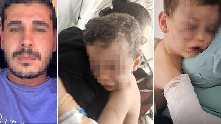 Denizli'de 2 Yaşındaki Aren'e İşkence: Tedavisi Tamamlandı, Devlet Korumasına Alındı