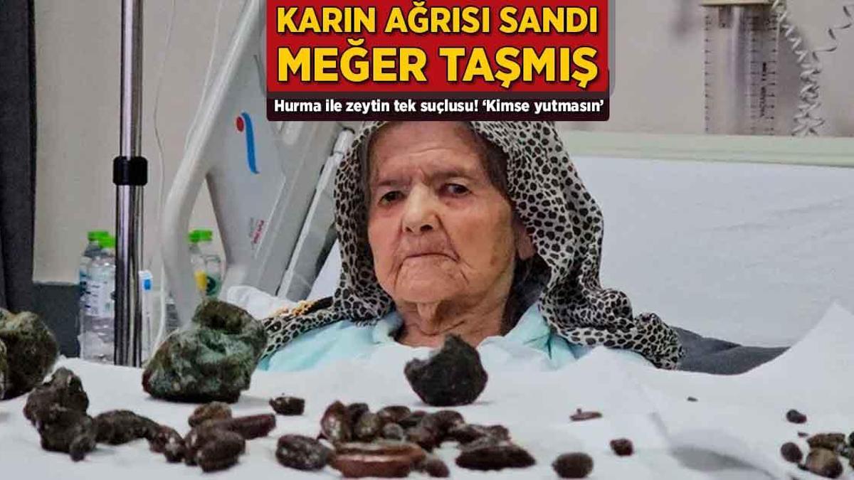 Hurma ve Zeytin Tüketimi Şok Yaşattı: 92 Yaşındaki Şerife Ay'ın Bağırsağında Bulunanlar Doktorları Şaşkına Çevirdi