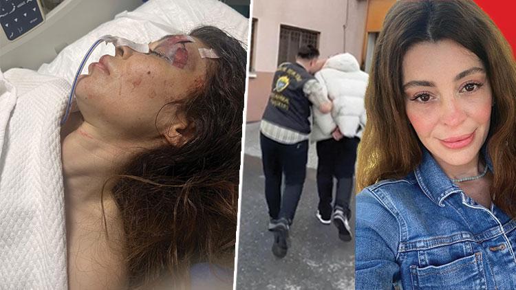 Beşiktaş'ta Şikayetçi Olduğu Spor Salonu Sahibi Tarafından Bıçaklanan Sibel M. Hastanede Yoğun Bakımda