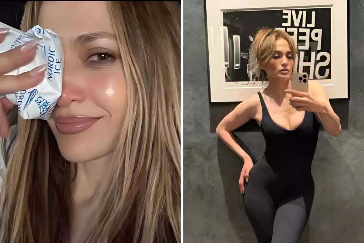 Jennifer Lopez, Amerikan Müzik Ödülleri Provalarında Yüzünden Yaralandı