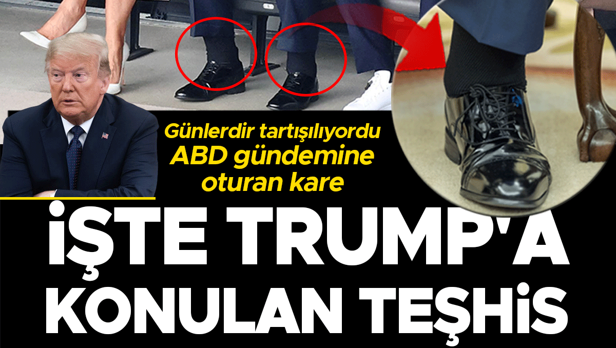 Trump'a Konulan Teşhis: Beyaz Saray'dan Açıklama Geldi